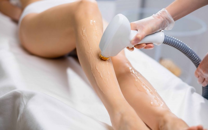 Lazer Epilasyon Nedir? Kimlere Uygulanır? Nasıl Uygulanır?